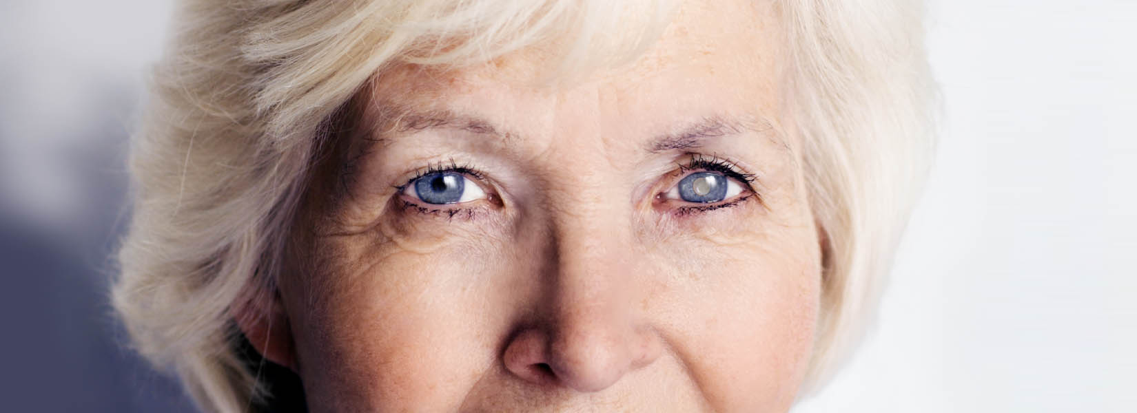 Cataract Surgery in Paris